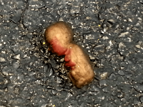 fetus in parking lot 1.png